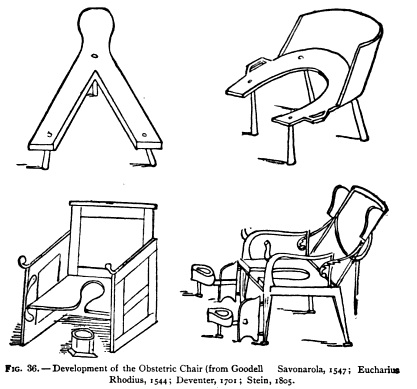 The “progression” of the obstetrical chair. The first stool is not unlike some modern  birthing stools, while the final incarnation is not too far displaced from the modern delivery-room bed.